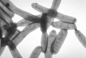 "Legionella pneumophila 01" by CDC (PHIL #1187) - CDC Public Health Image Library.. Licensed under Public domain via Wikimedia Commons - http://commons.wikimedia.org/wiki/File:Legionella_pneumophila_01.jpg#mediaviewer/File:Legionella_pneumophila_01.jpg